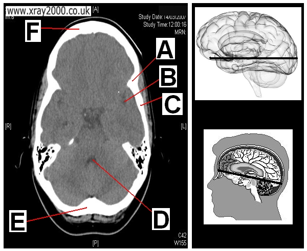 AXIAL SECTION 9.JPG